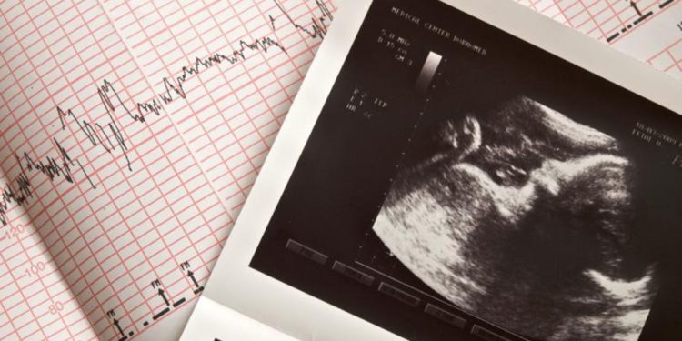 Бьющиеся сердца младенцев вырезаются во время абортов для нужд биомедицинских компаний