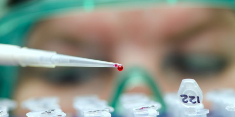 ООН надеется обуздать СПИД/ВИЧ к 2030 году