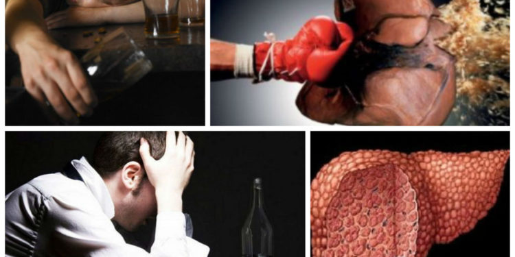 Употребление алкоголя подростками повышает риск возникновения цирроза печени во взрослом возрасте