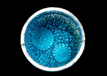 Ученые доказали способность эмбрионов обучаться еще в материнской утробе