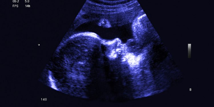 10 удивительных вещей, которые происходят с ребёнком до рождения