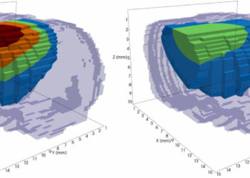 Медики из США используют суперкомпьютеры для прогноза развития рака и выбора методов его лечения