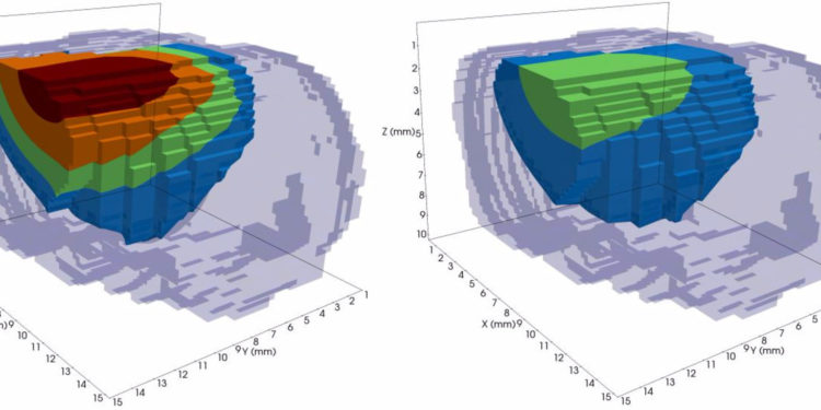 Медики из США используют суперкомпьютеры для прогноза развития рака и выбора методов его лечения