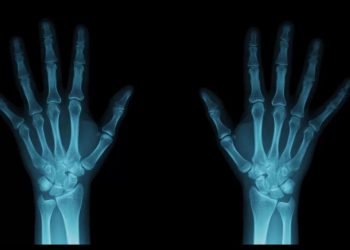 Ученые придумали способ усилить рентгеновское излучение