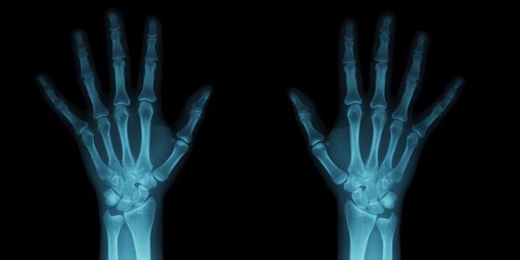 Ученые придумали способ усилить рентгеновское излучение