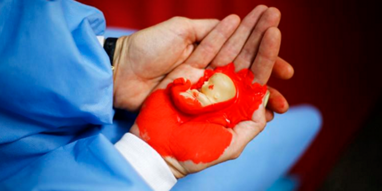 Христианин в США, отказавшийся платить налоги пока не отменять финансирование абортов, выиграл первое слушание в суде