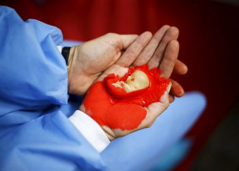 Журнал Lancet и Институт Гуттмахера хотят включить легализацию абортов в планы ВОЗ