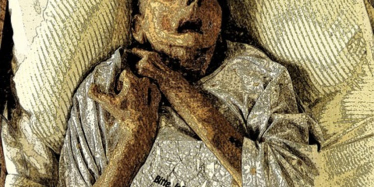 Эвтаназия: потеря памяти и воображения