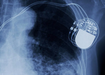 Обнаружен смертельно опасный баг в сотнях тысяч используемых кардиостимуляторов