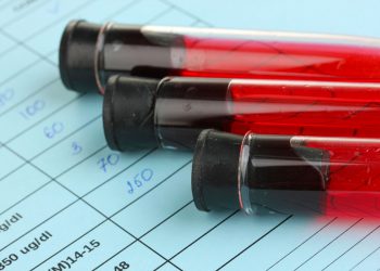 Минздрав РФ: в стране зарегистрировано 730 тысяч ВИЧ-инфицированных