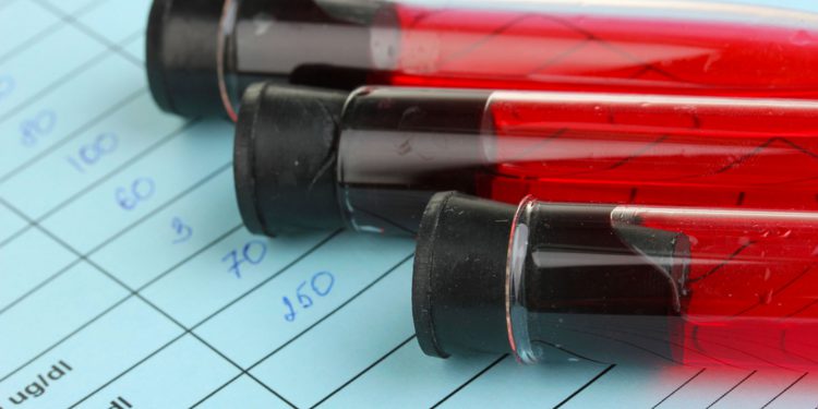 Минздрав РФ: в стране зарегистрировано 730 тысяч ВИЧ-инфицированных