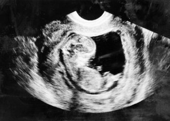 В США открылись онлайн-курсы для «проповедников» абортов