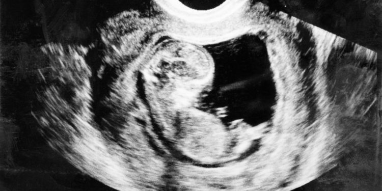 В США открылись онлайн-курсы для «проповедников» абортов