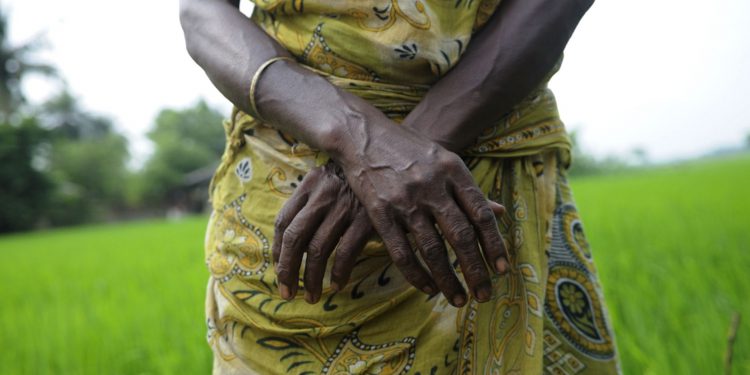 Программа массовой стерилизации женщин в Индии вызвала международную критику