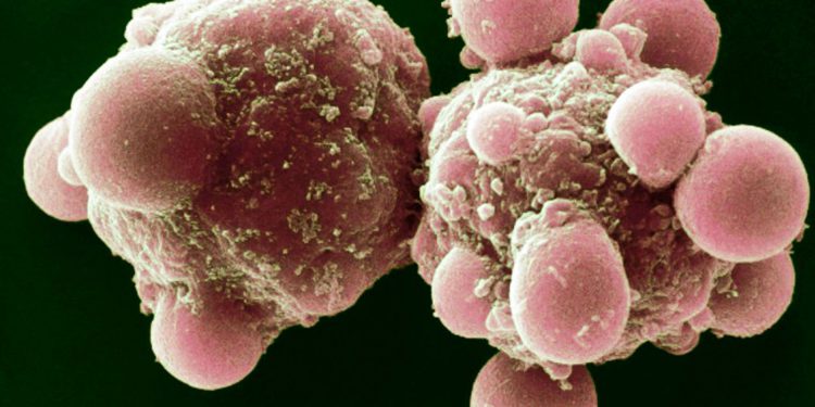 Стратегия замедления старения прошла первую проверку