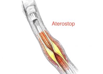 Российские врачи сделали  бесплатный  калькулятор сердечного риска для врачей и пациентов
