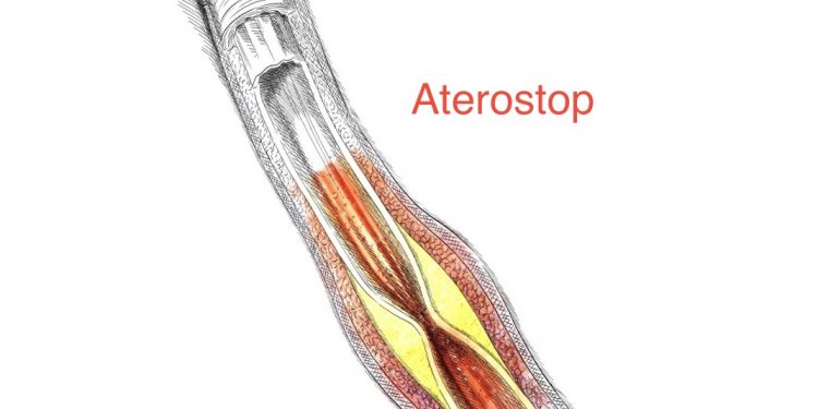 Российские врачи сделали  бесплатный  калькулятор сердечного риска для врачей и пациентов